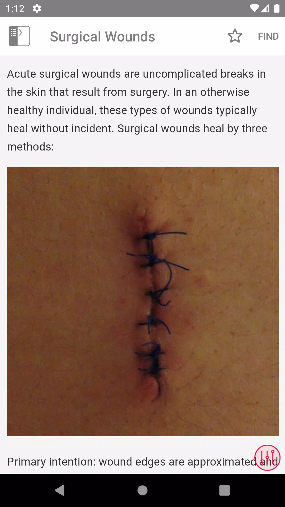 Wound Care MI Visual ภาพหน้าจอ 3